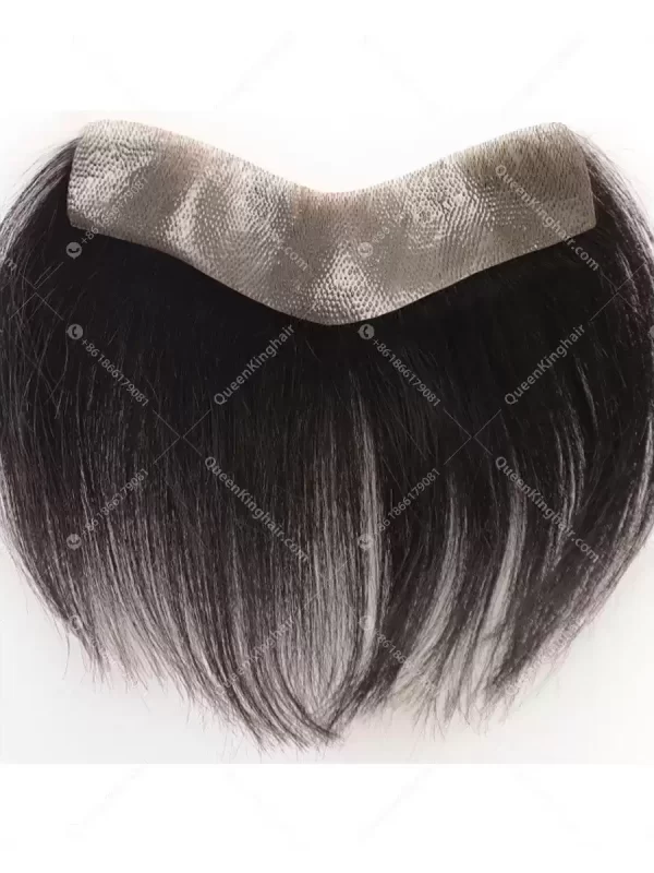 Natural hairline