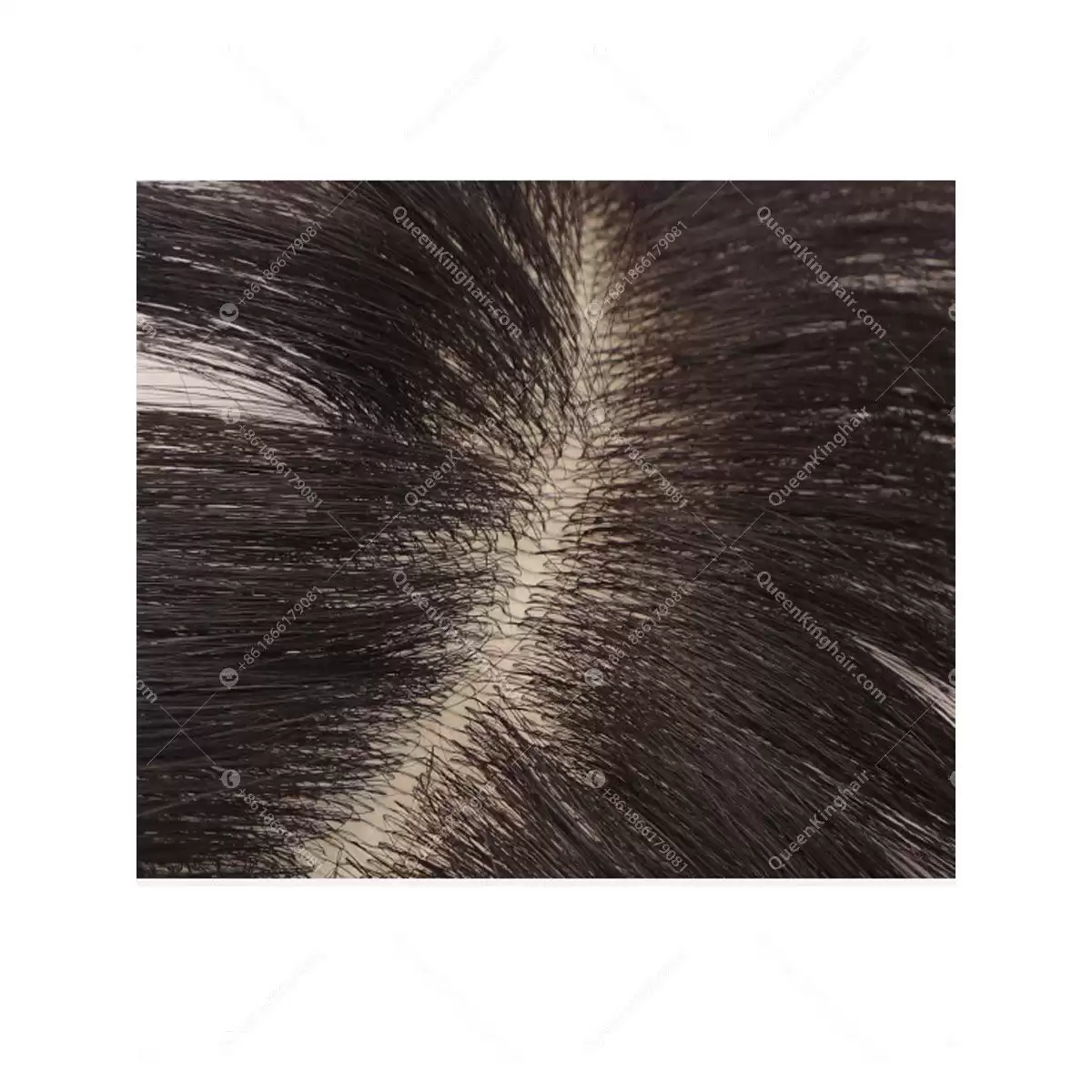 Natural hairline