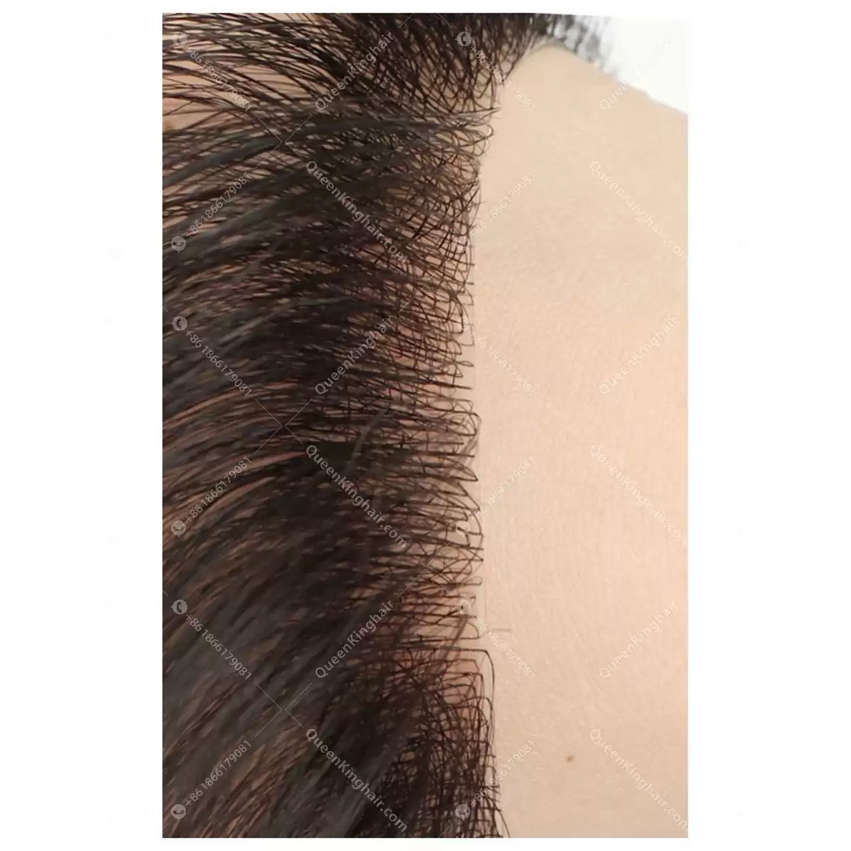 Natural hairline